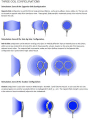 ICES® DigiCeutical® M1 Model System